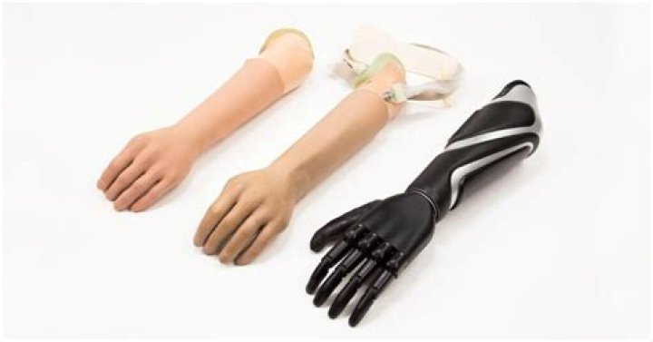 Bionic arm - How To Discuss