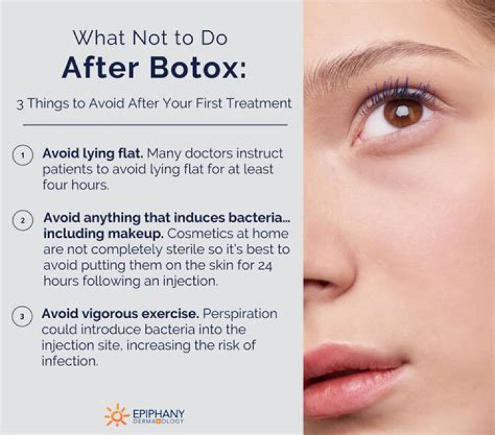 what to do after botox in forehead